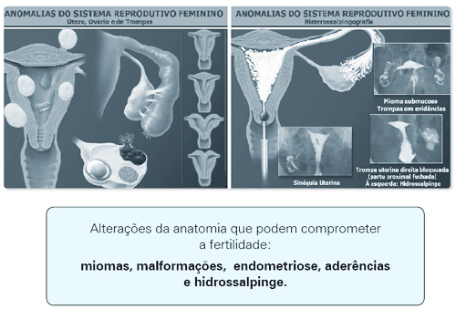 As cirurgias e o comprometimento da fertilidade. Cirurgias do bem e as  cirurgias do mal (Grupo IPGO)